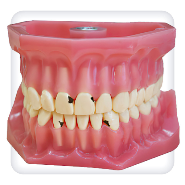 Model of the upper and lower jams with 32 model teeth for caries treatment