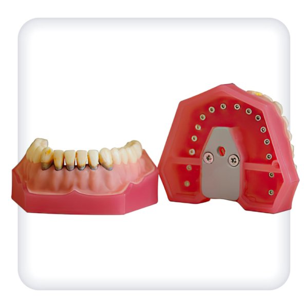 Model of the upper and lower jams with 32 model teeth for periodontal disease treatment