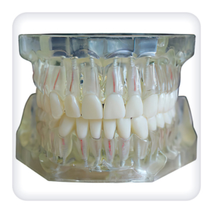 Model of the upper and lower jams with 32 intact teeth for endodontics