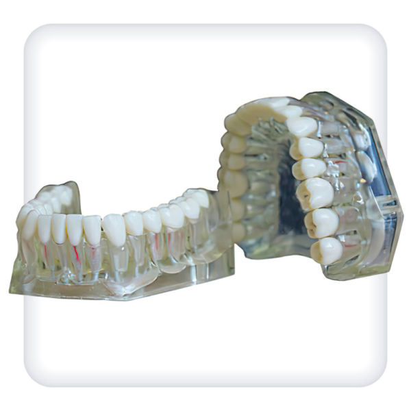Model of the upper and lower jams with 32 intact teeth for endodontics
