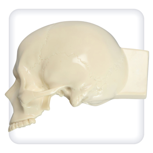 Skull model for practicing trepanation skills